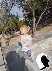 CI Kopf 2018 weiblich Kind